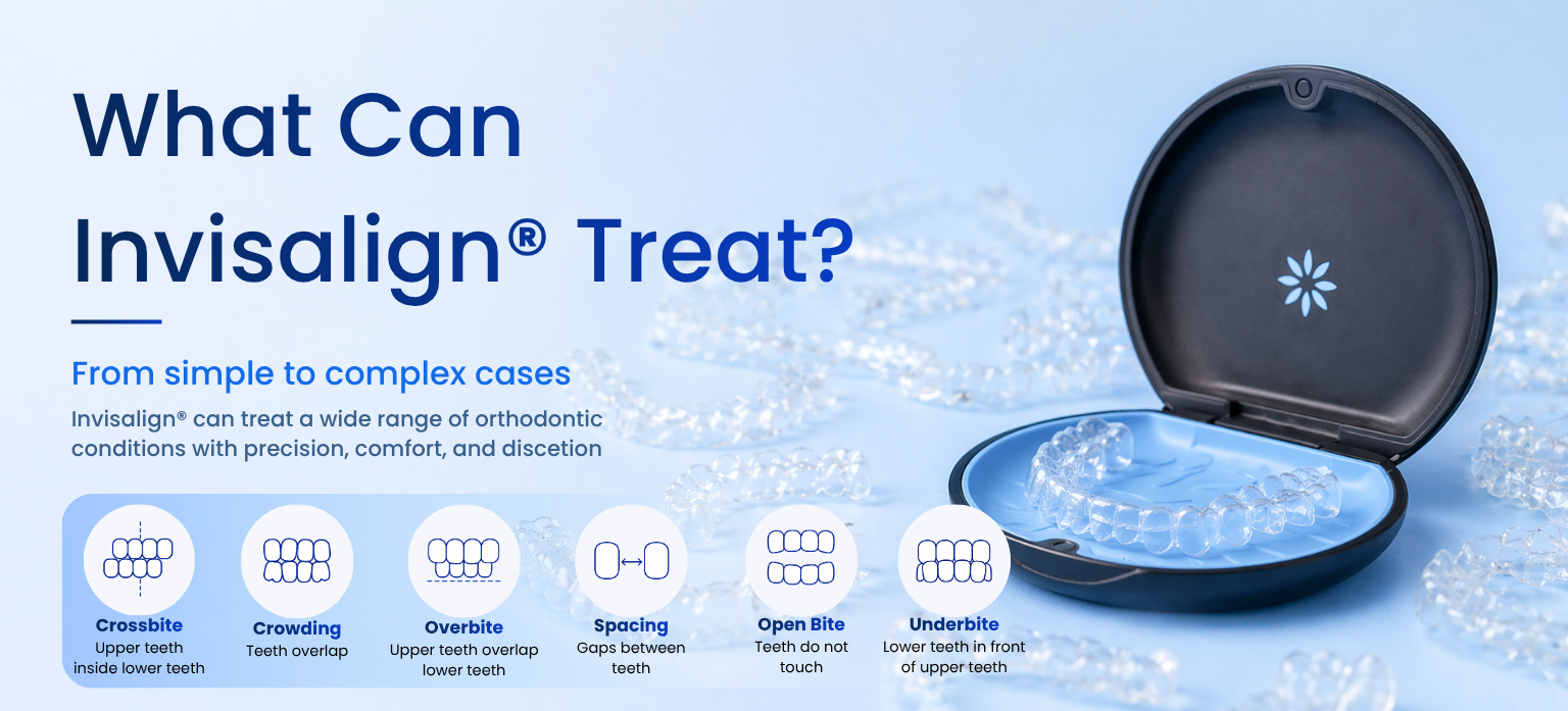 Invisalign® Treatable Cases - Dr. George Bardawil