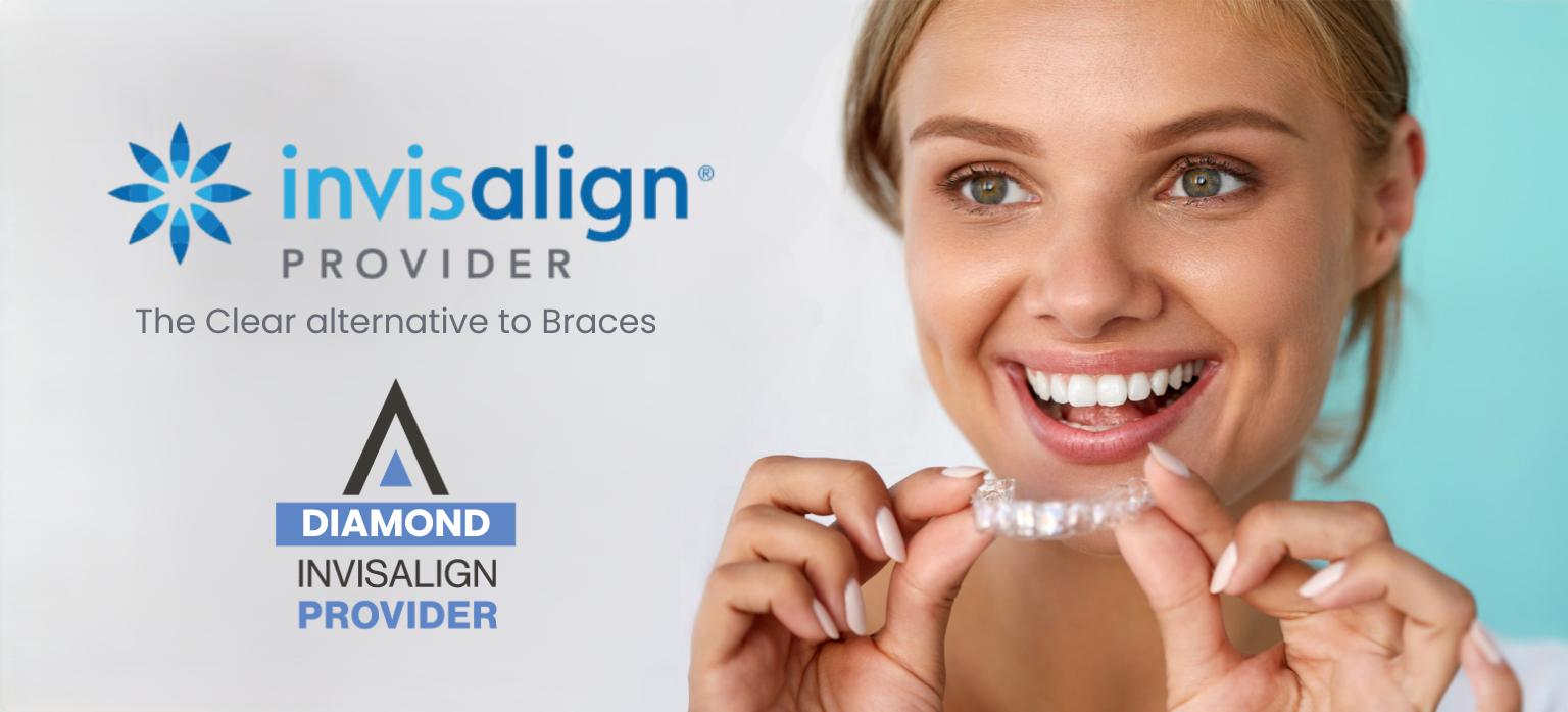 The Clear Alternative to Braces 2